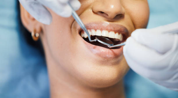 Best Emergency Dental Extractions in Cooper, TX